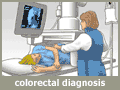 medical illustration - colorectal cancer diagnosis